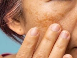 Hentikan Kulit Kusam! Perawatan Pagi dan Malam dengan Ekstrak Herbal untuk Kulit Lebih Segar