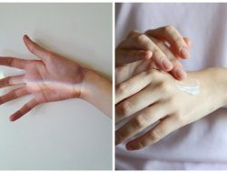 Trik skincare pemula: kulit belang hilang dalam 7 hari!